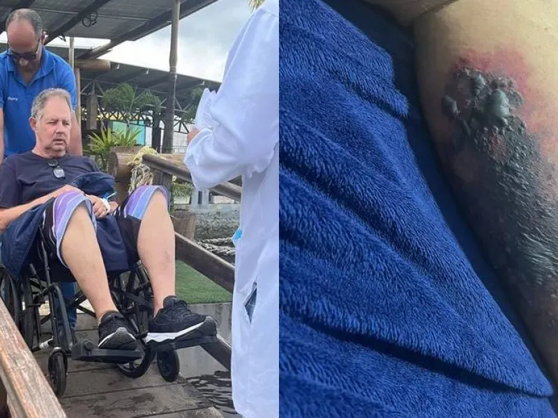 Turista morre após ser picado por aranha-marrom em Morro de São Paulo, na Bahia